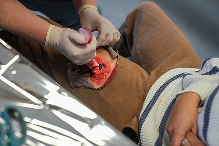 Person am Boden liegend mit größerer Verletzung an Oberschenkel